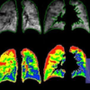 Polarean Imaging PLC